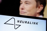 "Neuralink" implantı üçüncü insanın beyninə qoyuldu
